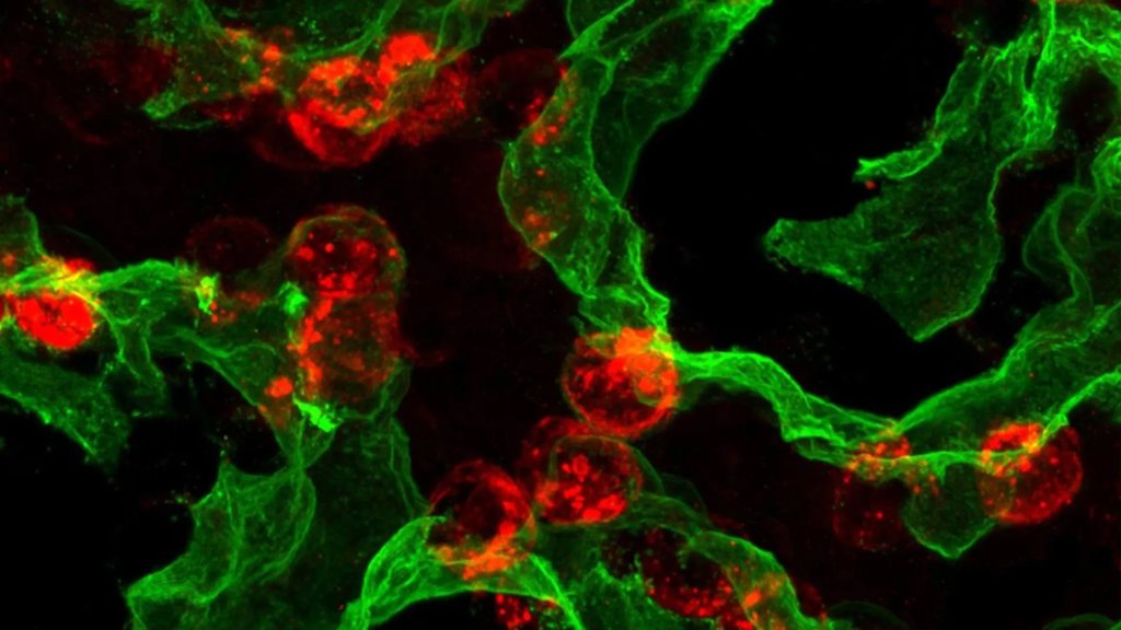 Scientists just found the lung&rsquo;s hidden self-healing switch | ScienceDaily